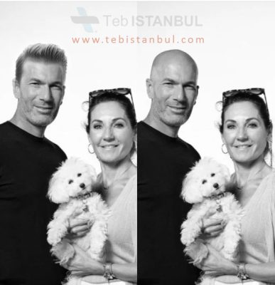 Zinedine Zidane vor und nach der Haartransplantation in Istanbul